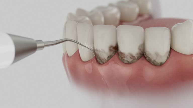 Reliable Dental Implants contractor in Maricopa, AZ by Smile Center Dentistry